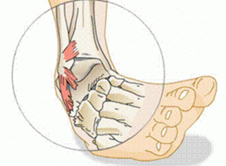 ANKLE INSTABILITY, Foot Medical Centre, Aurora Foot Specialist